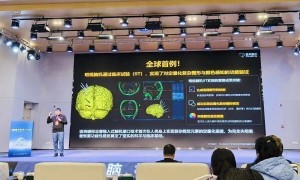 脑机接口走向落地：失语者重获“新声”，失明者重见光明