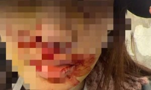 涉嫌逃逸找人顶包？金晨道歉：助理紧张冒名认责、不存在骗保